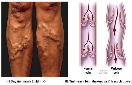 4. Chẩn Đoán Và Đánh Giá Mức Độ Bệnh